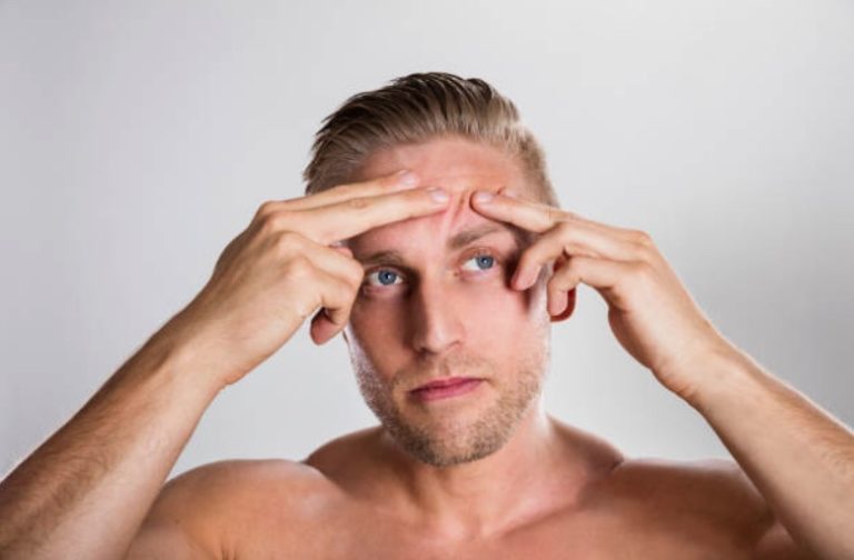 boutons points noirs impuretés peau
